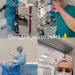 Ризотомия при ДЦП - Спинной мозг